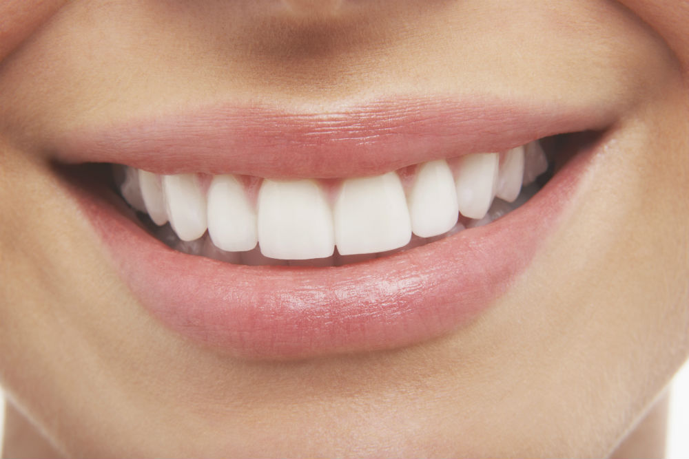 Teeth whitening dangers why you should only Trust a Dentist Fulham