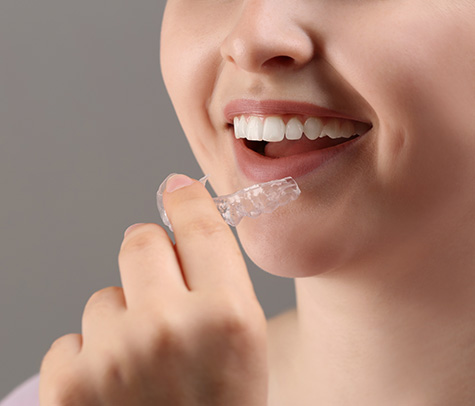 mouthguard-while-wearing-braces-fulham-dental-centre